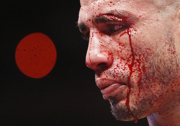 Boxer Cotto from Puerto Rico stares bloodied during fourth round of a WBO World Welterwight Title fight against Clottey from Ghana in New York Boxer Cotto from Puerto Rico